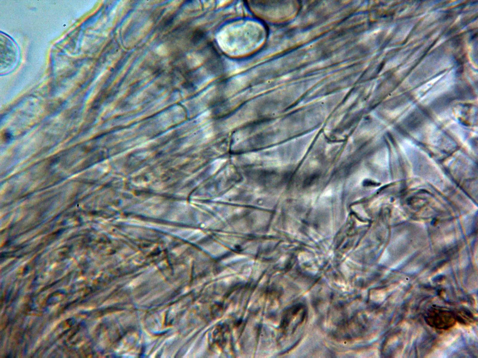 Microscopía de Macrolepiota fuliginosa - 10 - Pileipellis agua 1